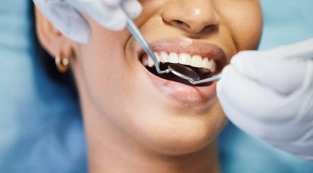 Best Same-Day Emergency Dental Services in Bonnetsville, NC